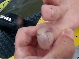 craigs toe